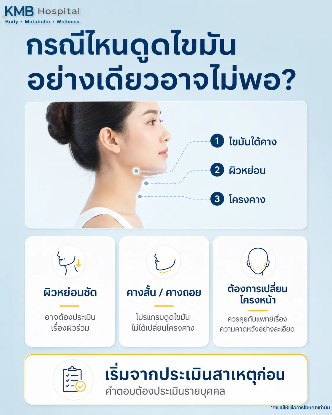 ภาพอินโฟกราฟิก KMB Hospital อธิบายกรณีที่โปรแกรมดูดไขมันเหนียงเพียงอย่างเดียวอาจไม่เพียงพอ เช่น ผิวหย่อนชัด คางสั้นหรือคางถอย และผู้ที่ต้องการเปลี่ยนโครงหน้า จึงควรเริ่มจากการประเมินสาเหตุและวางแผนเฉพาะบุคคล
