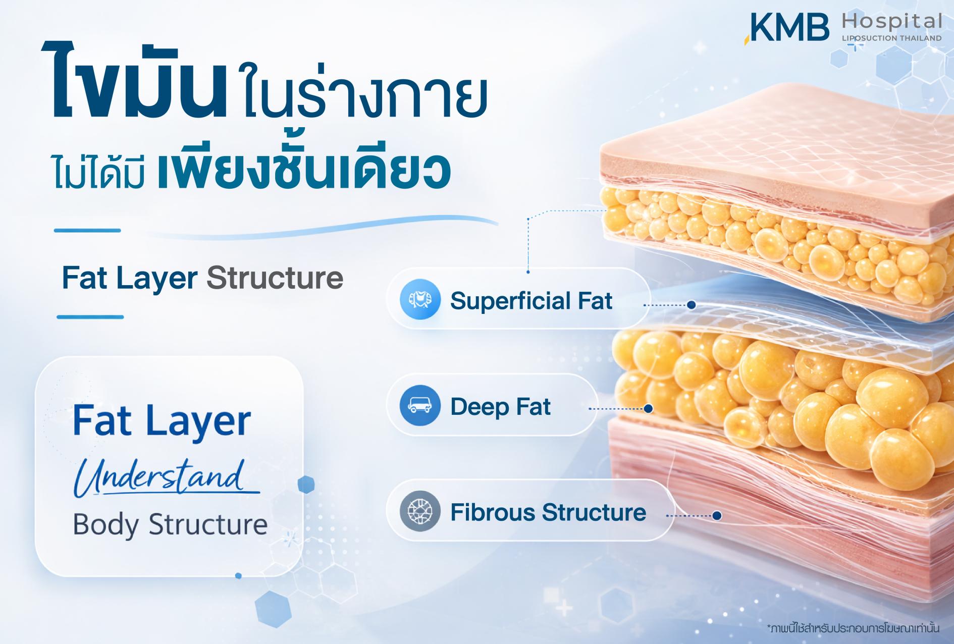 อินโฟกราฟิก KMB Hospital อธิบายโครงสร้างชั้นไขมันในร่างกาย ซึ่งไม่ได้มีเพียงชั้นเดียว โดยแสดงไขมันชั้นตื้น ไขมันชั้นลึก และโครงสร้างพังผืดที่แตกต่างกัน