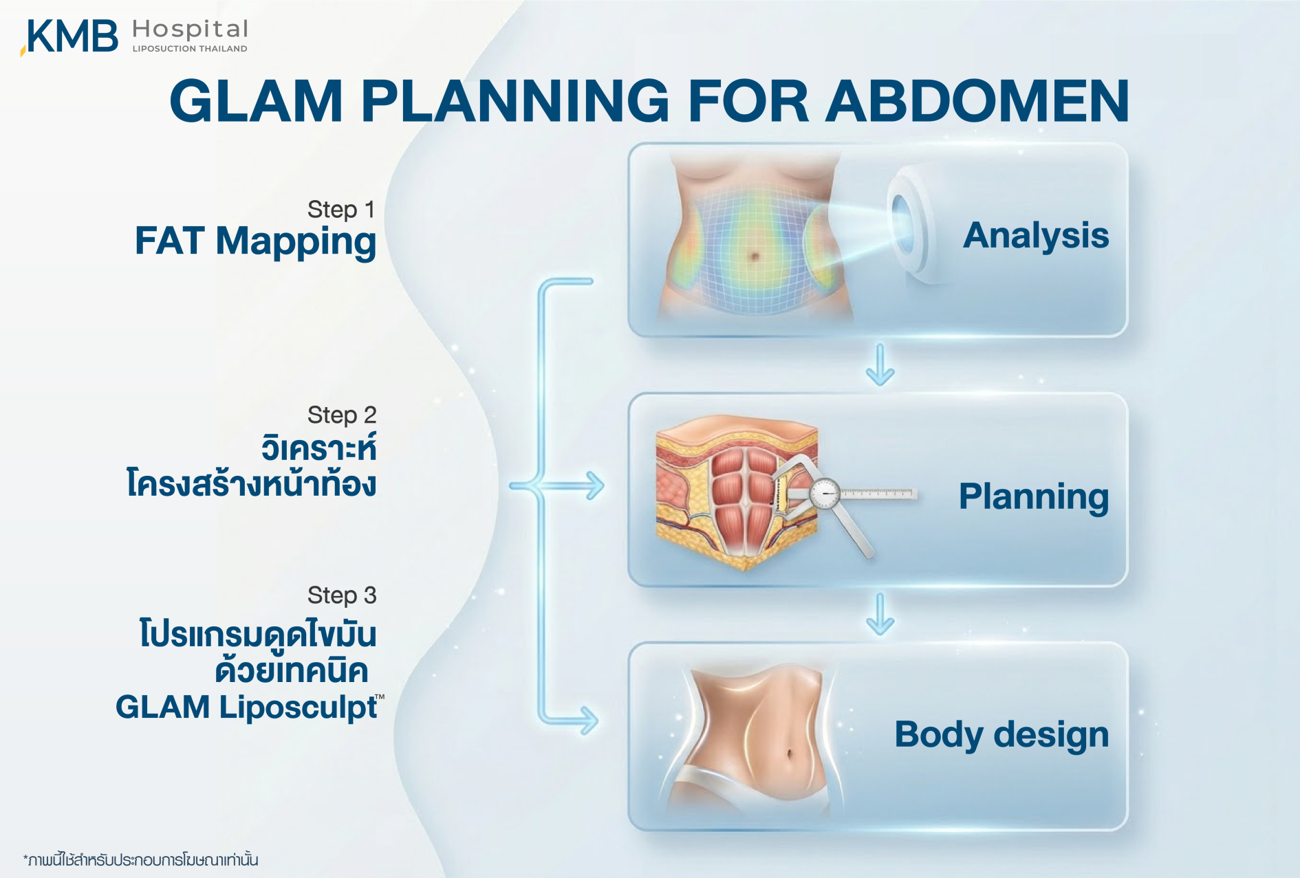 อินโฟกราฟิก KMB Hospital อธิบายการวางแผนโปรแกรมดูดไขมันหน้าท้อง GLAM Liposculpt ตั้งแต่การประเมินด้วย FAT Mapping การวิเคราะห์โครงสร้างหน้าท้อง ไปจนถึงการออกแบบสัดส่วนเฉพาะบุคคล