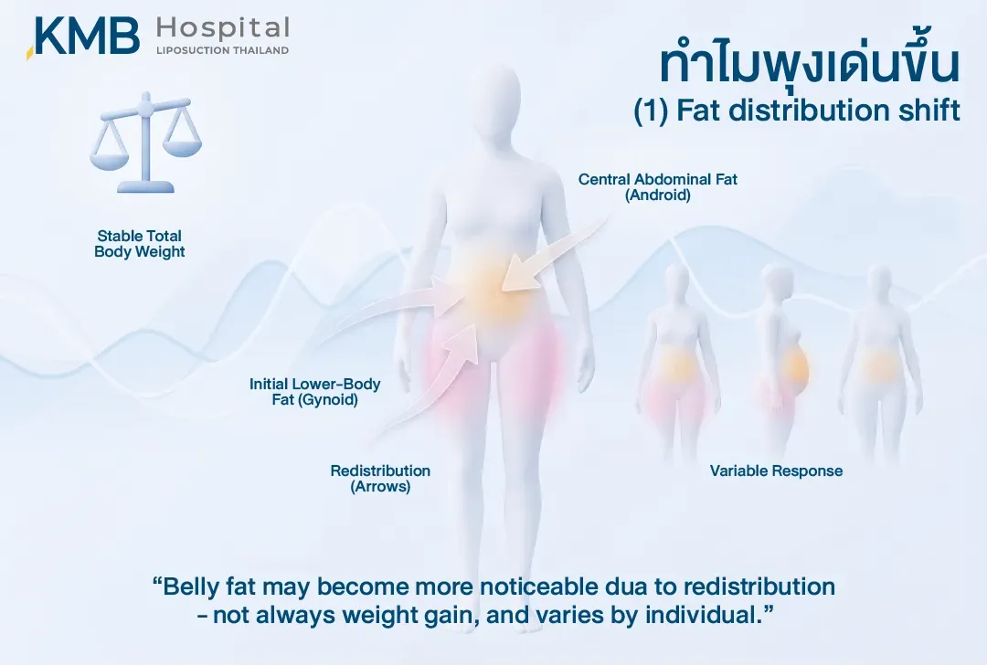 อินโฟกราฟิกอธิบายการกระจายไขมันในช่วง Perimenopause จากบริเวณสะโพกและต้นขามายังหน้าท้องส่วนกลาง แม้น้ำหนักตัวโดยรวมอาจคงที่ โดยรูปแบบการเปลี่ยนแปลงแตกต่างกันในแต่ละบุคคล