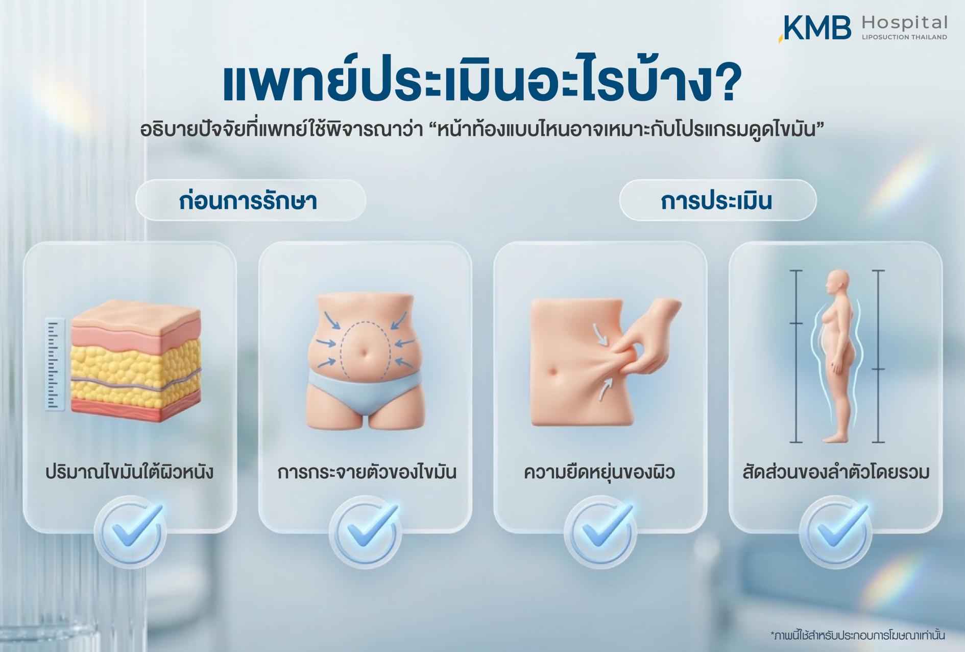 อินโฟกราฟิก KMB Hospital อธิบายปัจจัยที่แพทย์ใช้ประเมินก่อนทำโปรแกรมดูดไขมันหน้าท้อง ได้แก่ ปริมาณไขมันใต้ผิวหนัง การกระจายตัวของไขมัน ความยืดหยุ่นของผิว และสัดส่วนลำตัวโดยรวม