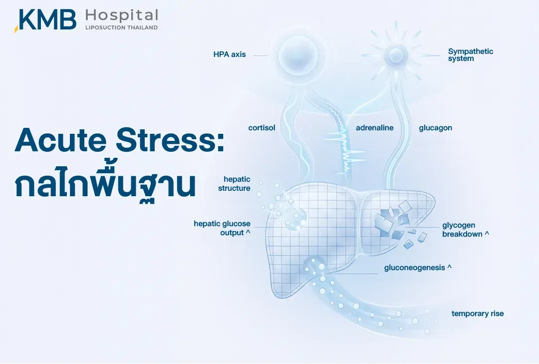 อินโฟกราฟิกแสดงกลไกความเครียดเฉียบพลันที่กระตุ้น HPA Axis และระบบประสาท Sympathetic ให้หลั่ง Cortisol, Adrenaline และ Glucagon ส่งสัญญาณไปยังตับให้เพิ่มการสลายไกลโคเจน การสร้างกลูโคสใหม่ และการปล่อยกลูโคสเข้าสู่กระแสเลือด ส่งผลให้ระดับน้ำตาลเพิ่มขึ้นชั่วคราว