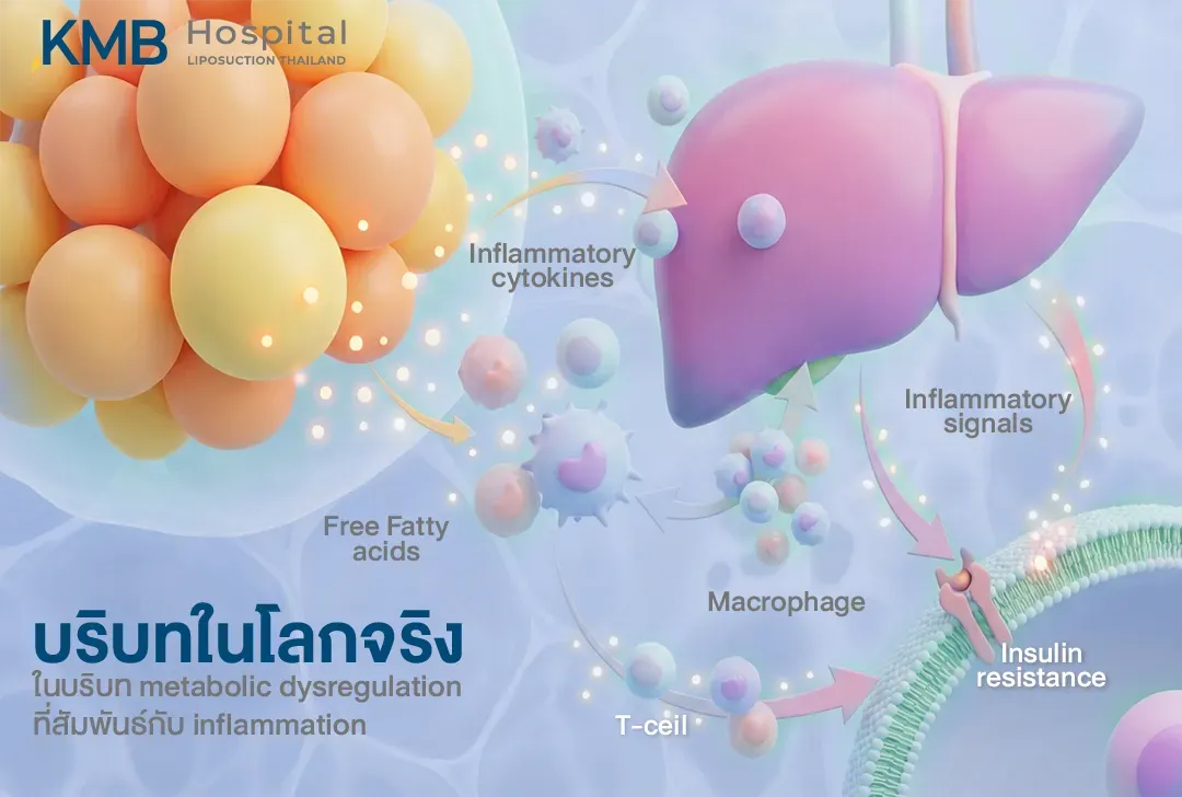 อินโฟกราฟิกอธิบายกลไกการอักเสบระดับต่ำในภาวะ Metabolic Dysregulation โดยเชื่อมโยงเนื้อเยื่อไขมัน กรดไขมันอิสระ Inflammatory Cytokines เซลล์ Macrophage และ T-cell กับการส่งสัญญาณการอักเสบที่อาจสัมพันธ์กับภาวะดื้อต่ออินซูลิน