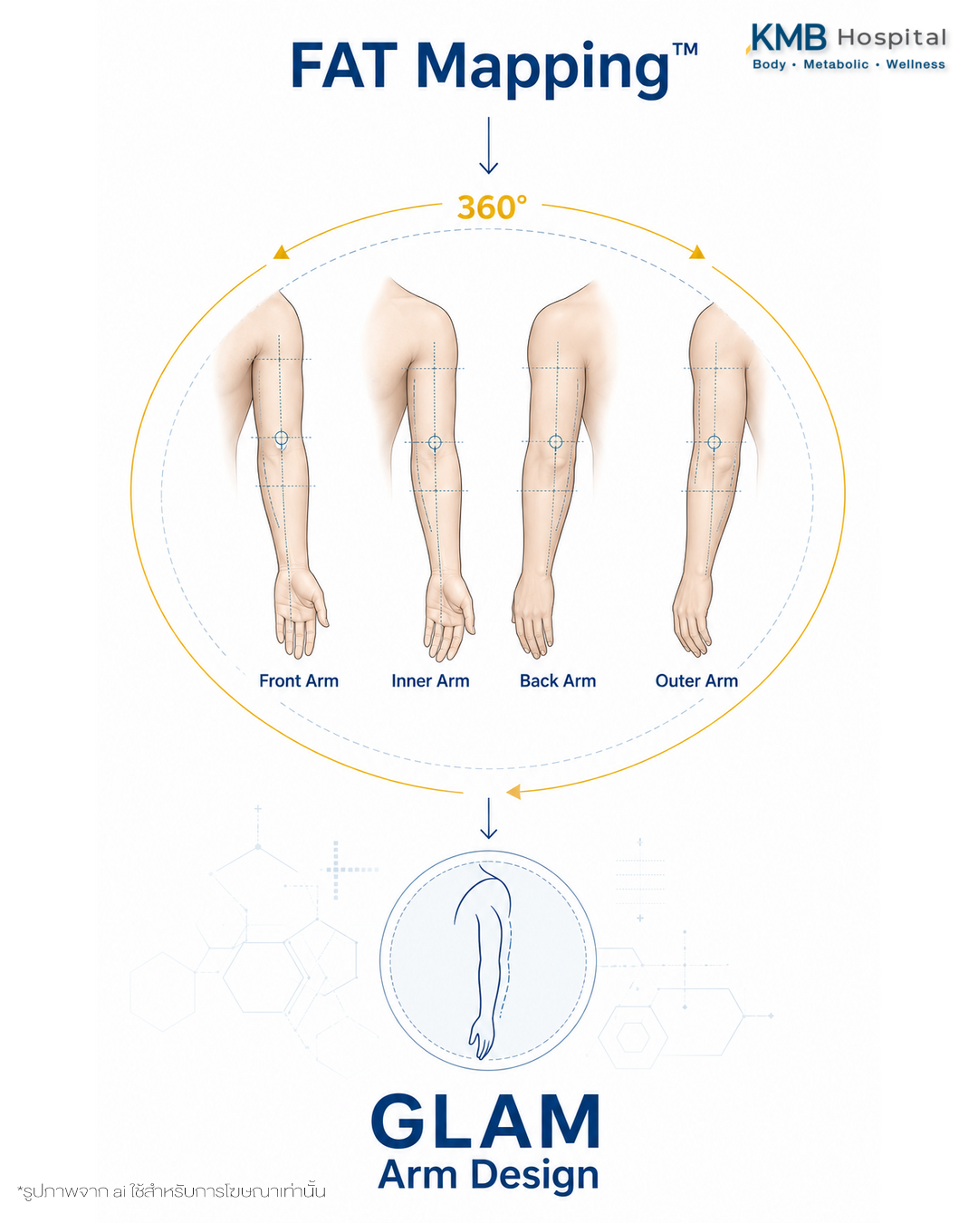 อินโฟกราฟิกแสดงการประเมินต้นแขนแบบ 360 องศาก่อนดูดไขมัน