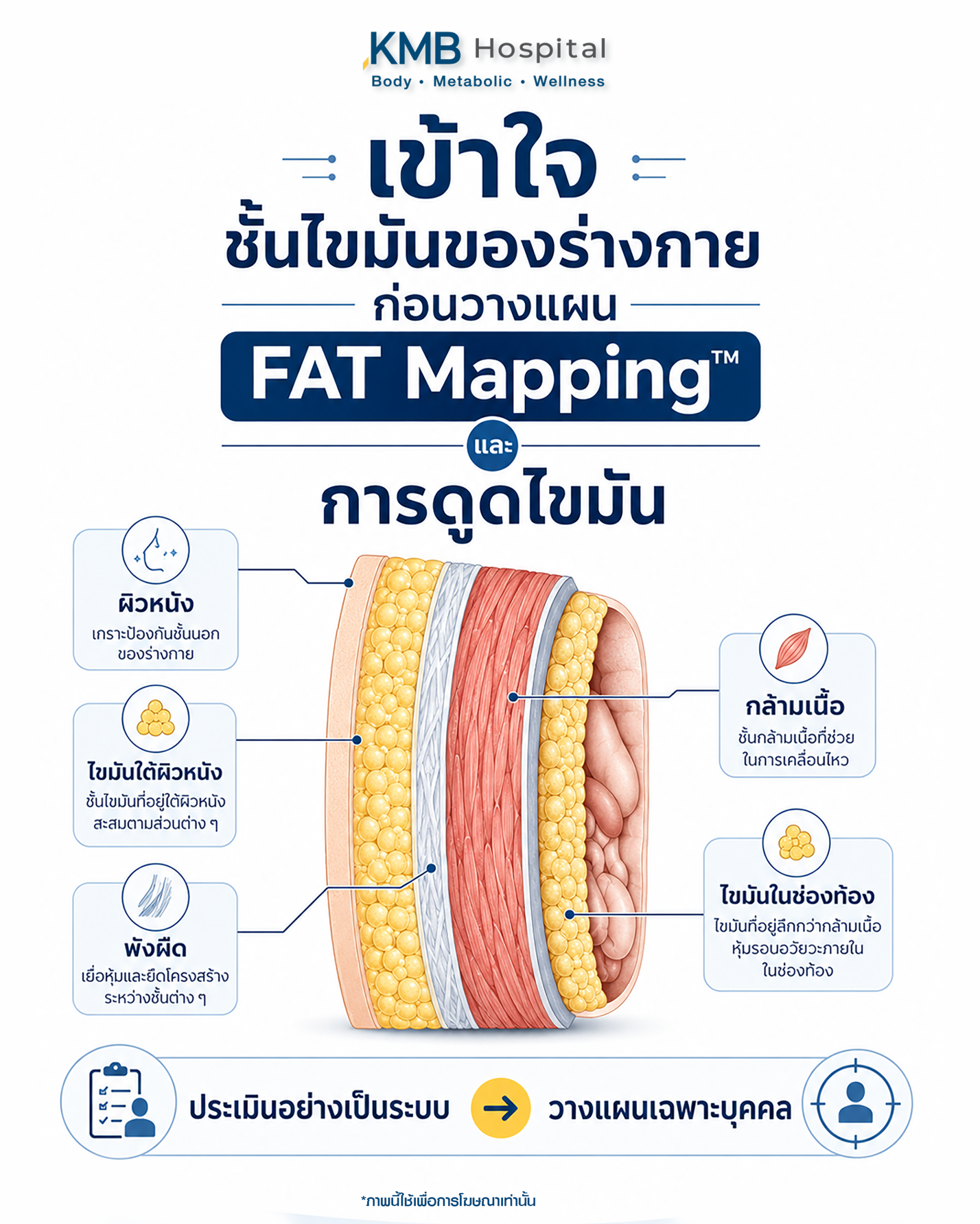 อินโฟกราฟิกสรุปชั้นไขมันของร่างกายและองค์ประกอบที่แพทย์ใช้ประเมินก่อนดูดไขมัน