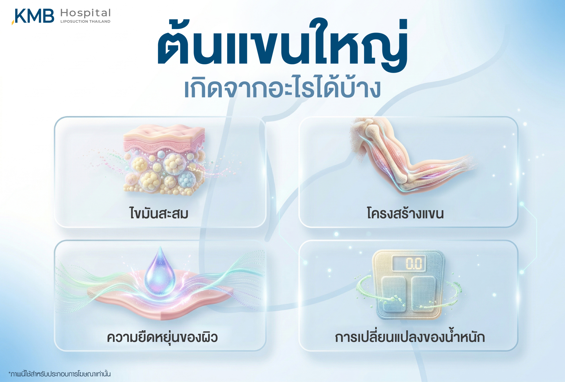 อินโฟกราฟิก KMB Hospital อธิบายสาเหตุที่ทำให้ต้นแขนดูใหญ่ ได้แก่ ไขมันสะสม โครงสร้างแขน ความยืดหยุ่นของผิว และการเปลี่ยนแปลงของน้ำหนัก ซึ่งควรประเมินร่วมกันก่อนวางแผนดูแล