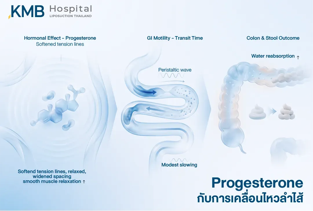 อินโฟกราฟิกอธิบายความสัมพันธ์ระหว่างฮอร์โมน Progesterone กับระบบทางเดินอาหาร โดยกล้ามเนื้อลำไส้อาจคลายตัว การบีบตัวและการเคลื่อนผ่านของอาหารช้าลง ทำให้ลำไส้ใหญ่ดูดน้ำกลับมากขึ้นและอุจจาระแข็งขึ้น