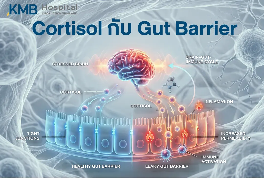 อินโฟกราฟิกแสดงความสัมพันธ์ระหว่างความเครียด Cortisol และ Gut Barrier โดยเปรียบเทียบผนังลำไส้ที่มี Tight Junctions แข็งแรงกับภาวะที่ความสามารถในการซึมผ่านเพิ่มขึ้น พร้อมการอักเสบและการกระตุ้นระบบภูมิคุ้มกัน