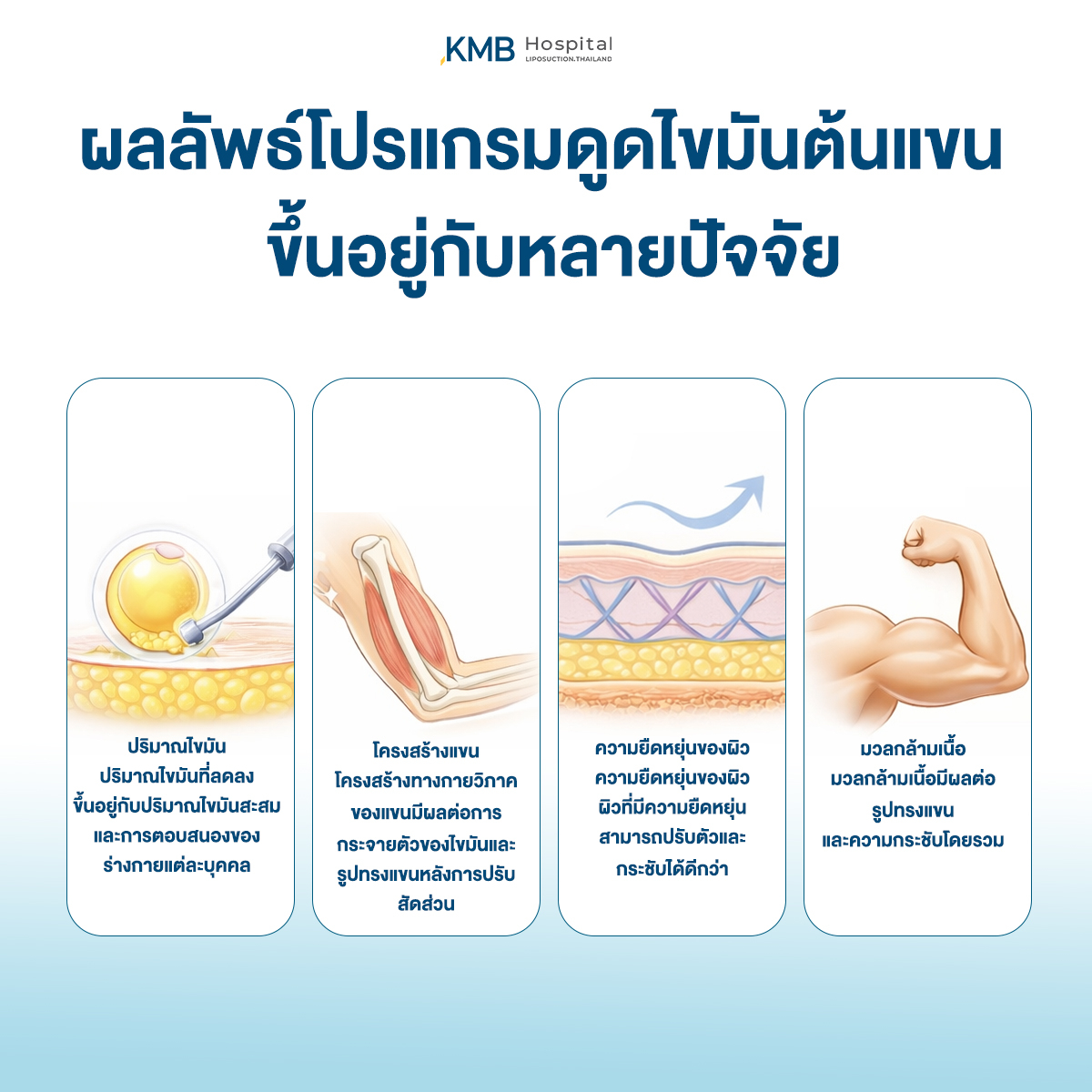 อินโฟกราฟิก KMB Hospital อธิบายปัจจัยที่ส่งผลต่อผลลัพธ์หลังโปรแกรมดูดไขมันต้นแขน ได้แก่ ปริมาณไขมัน โครงสร้างแขน ความยืดหยุ่นของผิว และมวลกล้ามเนื้อ ซึ่งแตกต่างกันในแต่ละบุคคล