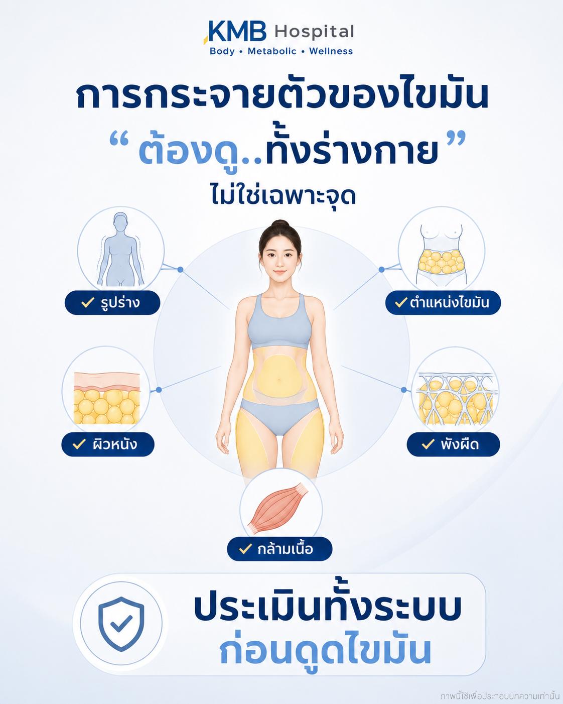 การกระจายตัวของไขมันแตกต่างกันในแต่ละบุคคล จึงต้องประเมินเป็นรายบุคคลก่อนวางแผนดูดไขมัน