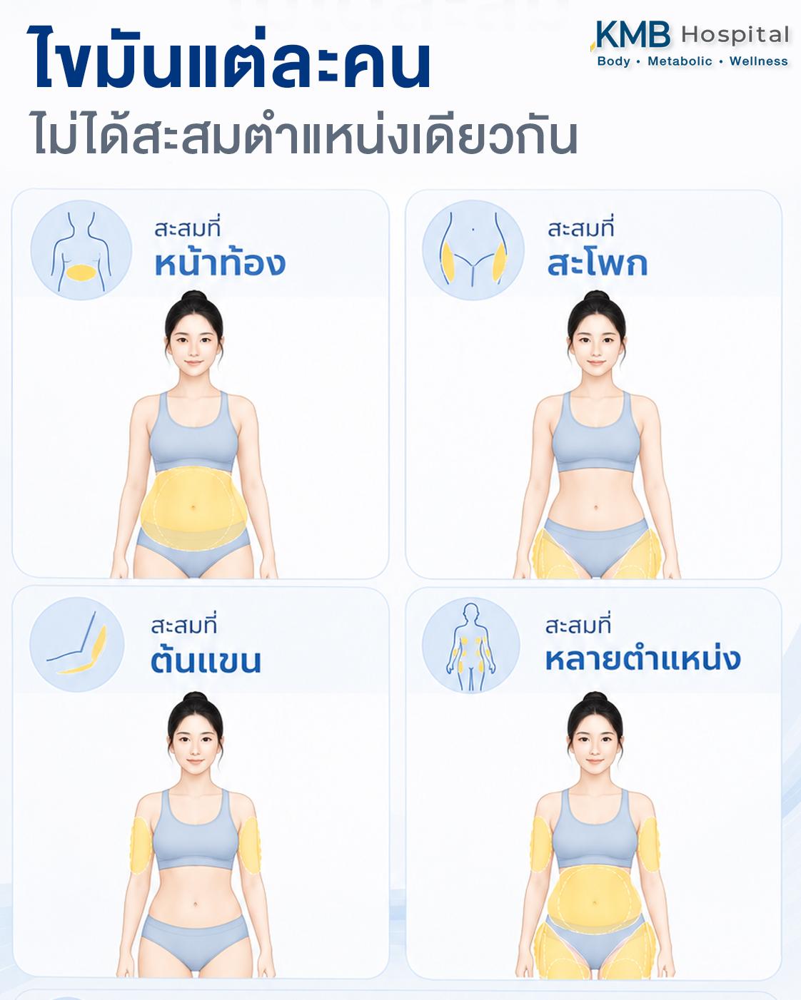 องค์ประกอบที่แพทย์ใช้ประเมินการกระจายตัวของไขมันก่อนดูดไขมัน การประเมินการกระจายตัวของไขมันต้องพิจารณารูปร่างทั้งร่างกาย ไม่ใช่เพียงตำแหน่งเดียว