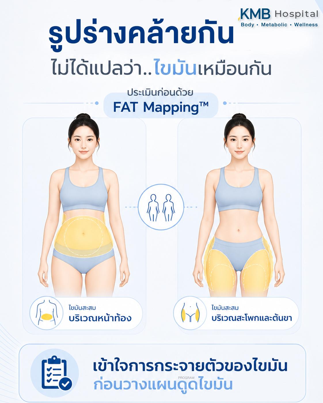 การกระจายตัวของไขมันแตกต่างกันในแต่ละบุคคล และมีผลต่อการประเมินก่อนดูดไขมัน