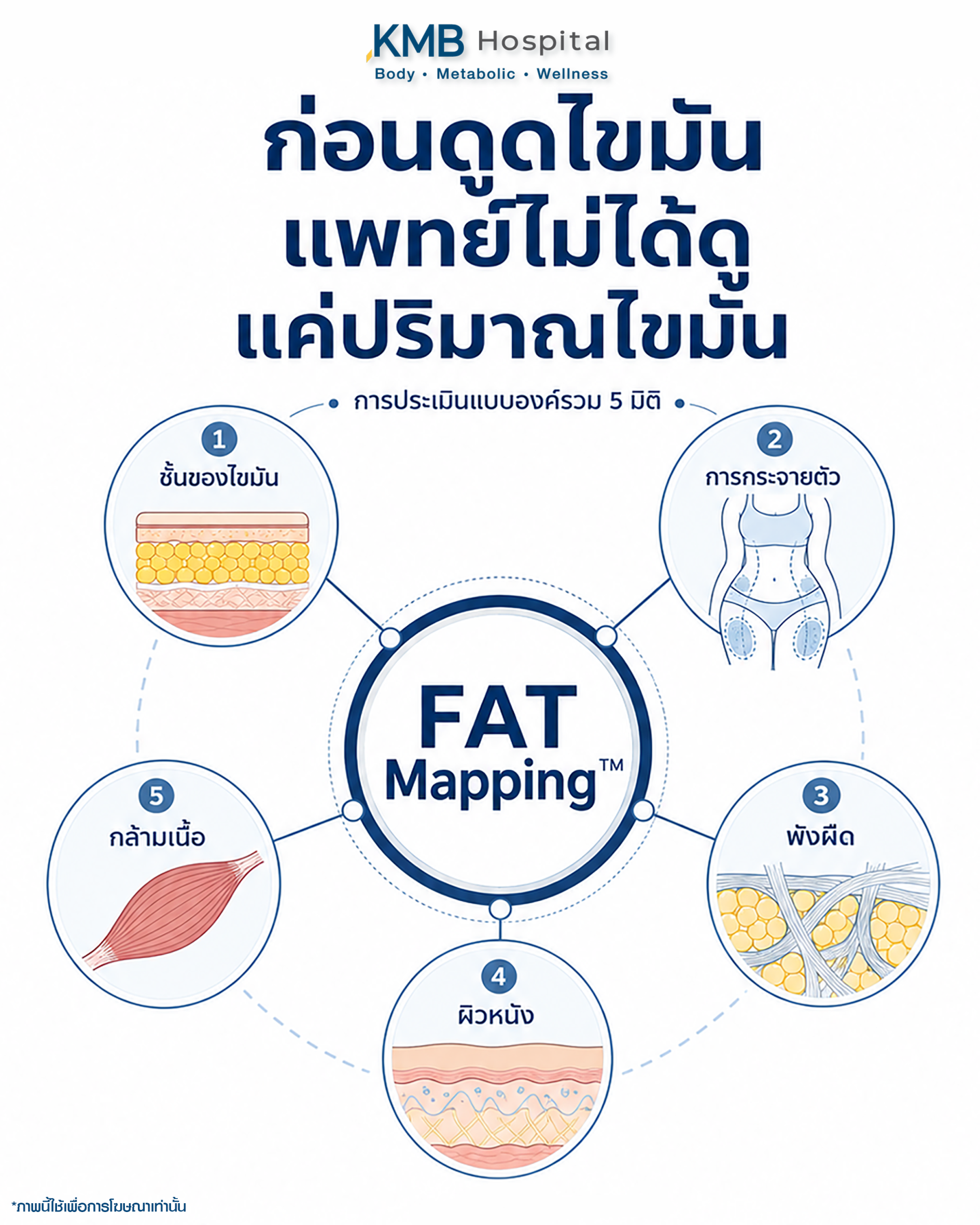 อินโฟกราฟิกแสดงองค์ประกอบที่แพทย์ใช้ประเมินก่อนวางแผนดูดไขมัน ได้แก่ ชั้นไขมัน การกระจายตัวของไขมัน พังผืด ผิวหนัง และกล้ามเนื้อ