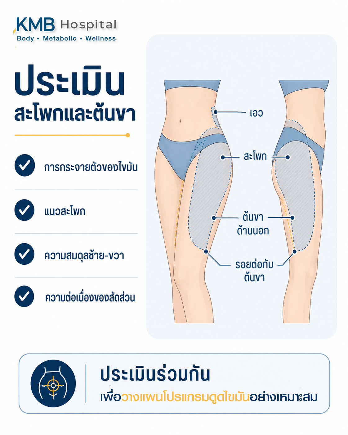 อินโฟกราฟิกแสดงองค์ประกอบที่ประเมินใน FAT Mapping™ ต้นขาด้านนอกและสะโพกก่อนดูดไขมัน