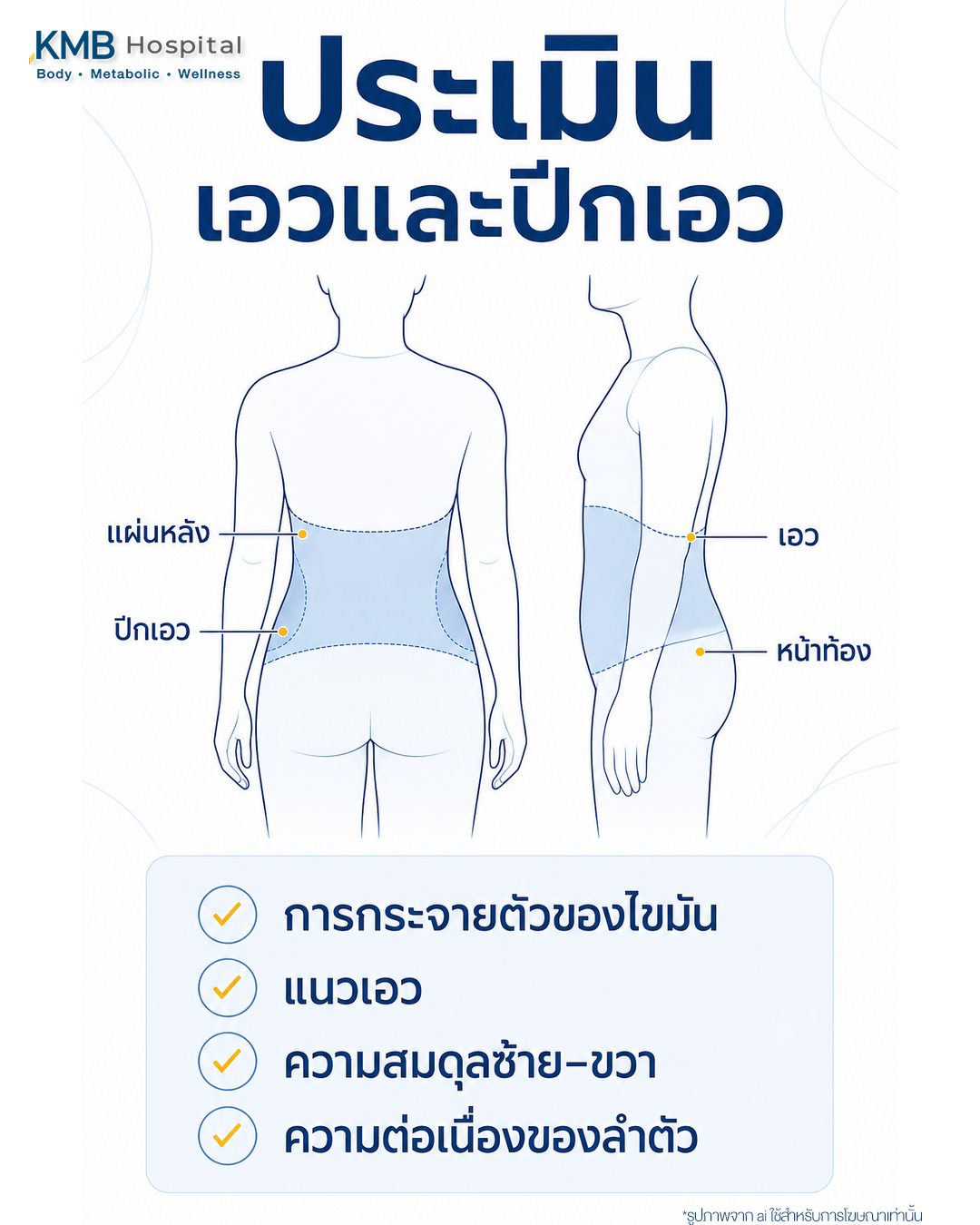 อินโฟกราฟิกแสดงองค์ประกอบที่ประเมินใน FAT Mapping™ เอวและปีกเอวก่อนดูดไขมัน