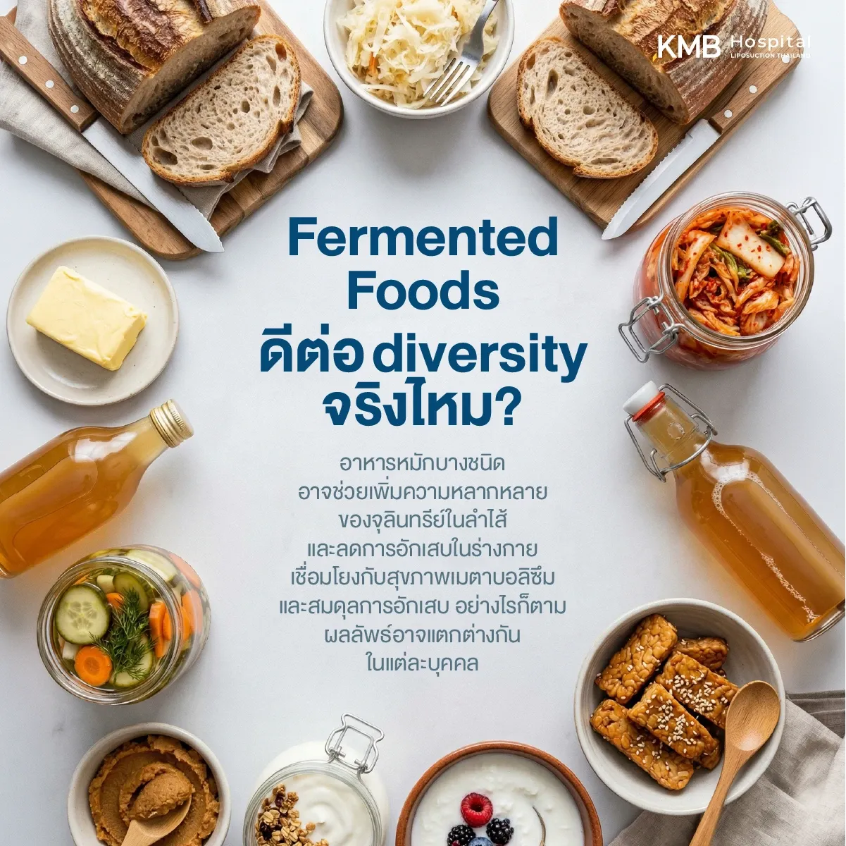 ภาพรวมอาหารหมัก เช่น กิมจิ ผักดอง โยเกิร์ต เทมเป้ และขนมปังหมัก อธิบายว่าอาหารหมักบางชนิดอาจช่วยเพิ่มความหลากหลายของจุลินทรีย์ในลำไส้และสนับสนุนสุขภาพเมตาบอลิซึม