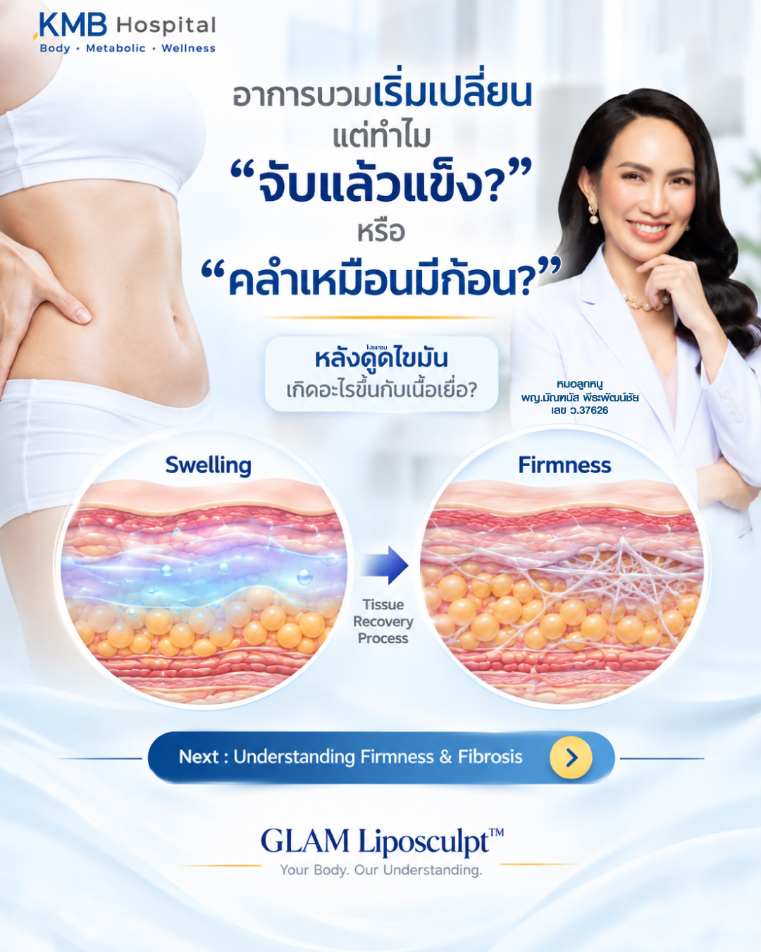 ภาพอธิบายคำถามเรื่องความแข็งหรือคลำพบก้อนในช่วงฟื้นตัวหลังดูดไขมัน