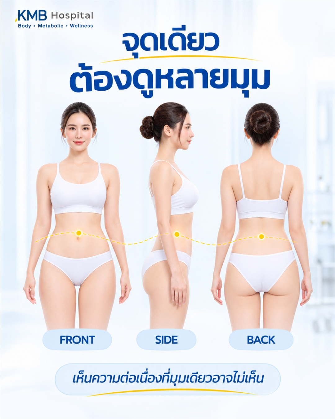 ภาพการประเมินรูปร่างผู้หญิงจากด้านหน้า ด้านข้าง และด้านหลัง เพื่อดูความต่อเนื่องของบริเวณต่าง ๆ ก่อนวางแผนโปรแกรมดูดไขมัน
