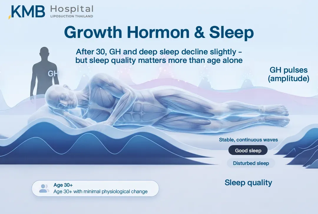 อินโฟกราฟิกแสดงความสัมพันธ์ระหว่าง Growth Hormone และการนอนหลับลึกในวัย 30 ปีขึ้นไป โดยเปรียบเทียบคลื่นการนอนที่ต่อเนื่องกับการนอนที่ถูกรบกวน ซึ่งอาจส่งผลต่อการหลั่ง Growth Hormone และการฟื้นตัวของร่างกาย