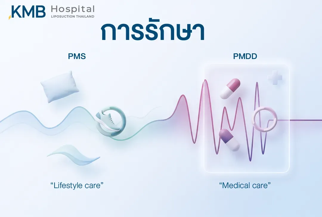 อินโฟกราฟิกเปรียบเทียบแนวทางการดูแล PMS และ PMDD โดย PMS อาจเริ่มจากการปรับพฤติกรรมและการใช้ชีวิต ส่วน PMDD อาจต้องได้รับการประเมินและดูแลทางการแพทย์