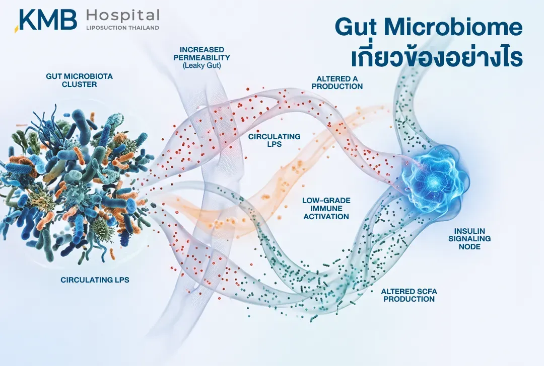 อินโฟกราฟิกแสดงความเชื่อมโยงระหว่าง Gut Microbiome การเพิ่มขึ้นของความซึมผ่านผนังลำไส้ การไหลเวียนของ LPS การอักเสบระดับต่ำ และการเปลี่ยนแปลงของ SCFA ซึ่งอาจเกี่ยวข้องกับการรบกวนระบบส่งสัญญาณของอินซูลิน