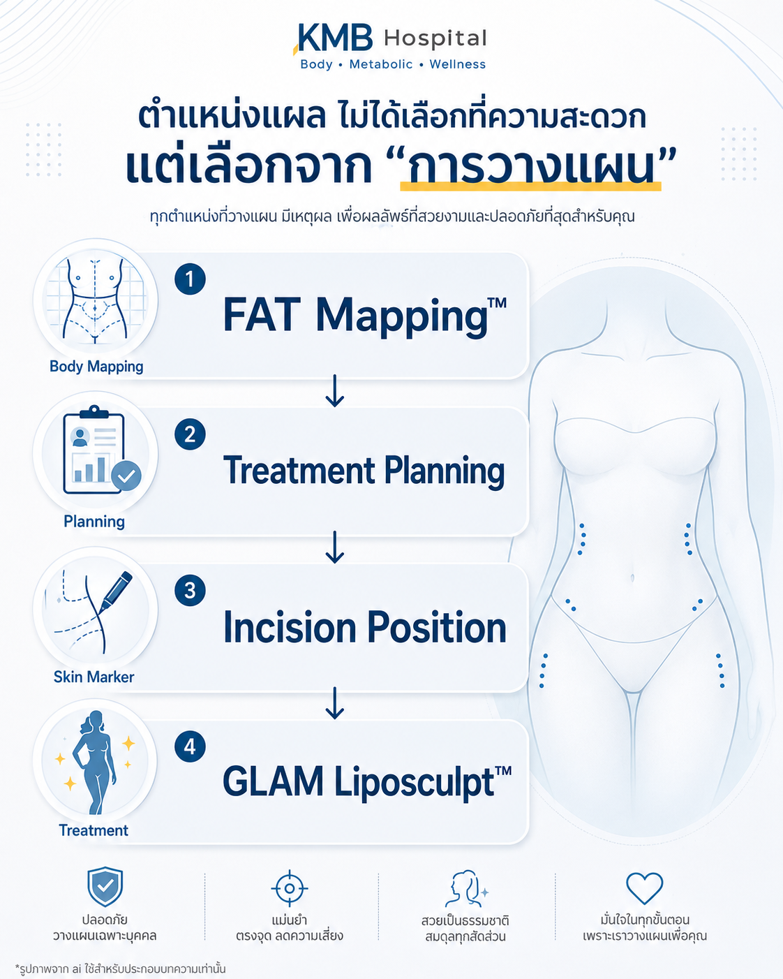 อินโฟกราฟิกแสดงการวางตำแหน่งของแผลก่อนการดูดไขมันแบบ GLAM