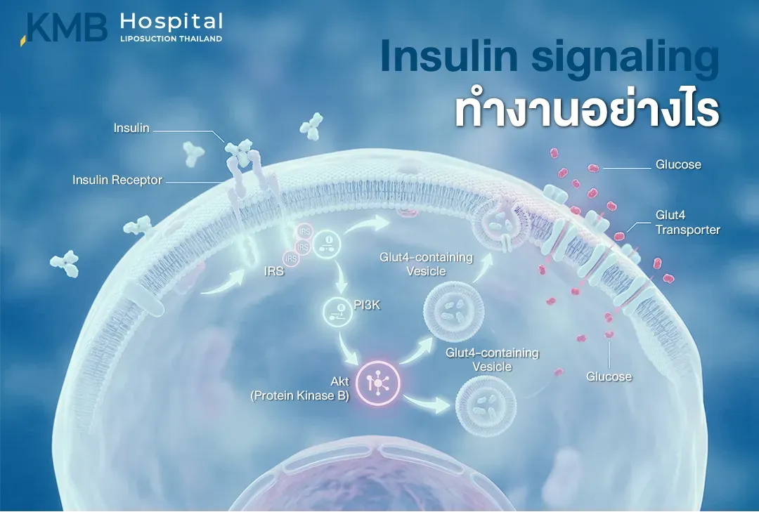 อินโฟกราฟิกแสดงกลไก Insulin Signaling เมื่ออินซูลินจับกับ Insulin Receptor และส่งสัญญาณผ่าน IRS, PI3K และ Akt ทำให้ GLUT4 เคลื่อนมายังเยื่อหุ้มเซลล์เพื่อช่วยนำกลูโคสเข้าสู่เซลล์