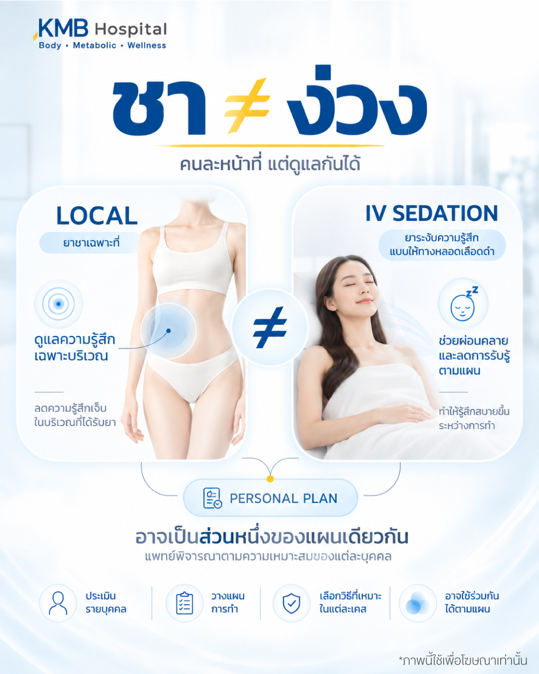 ภาพเปรียบเทียบยาชาเฉพาะที่กับ IV Sedation ในการดูดไขมัน โดยยาชาช่วยลดความรู้สึกเฉพาะบริเวณ ส่วน IV Sedation ช่วยเรื่องความผ่อนคลายและระดับการรับรู้ตามแผน