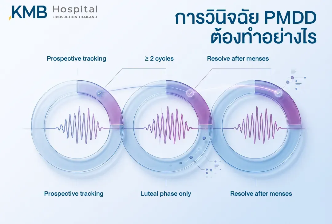 อินโฟกราฟิกอธิบายแนวทางการวินิจฉัย PMDD โดยติดตามอาการแบบ Prospective Tracking อย่างน้อย 2 รอบเดือน ตรวจว่าอาการเกิดเฉพาะช่วง Luteal Phase และดีขึ้นหลังมีประจำเดือน