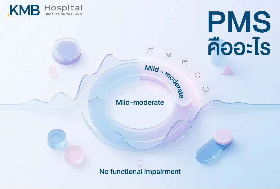อินโฟกราฟิกอธิบาย PMS หรือกลุ่มอาการก่อนมีประจำเดือน ซึ่งมักมีความรุนแรงระดับเล็กน้อยถึงปานกลาง และโดยทั่วไปไม่กระทบต่อการใช้ชีวิตประจำวันอย่างชัดเจน