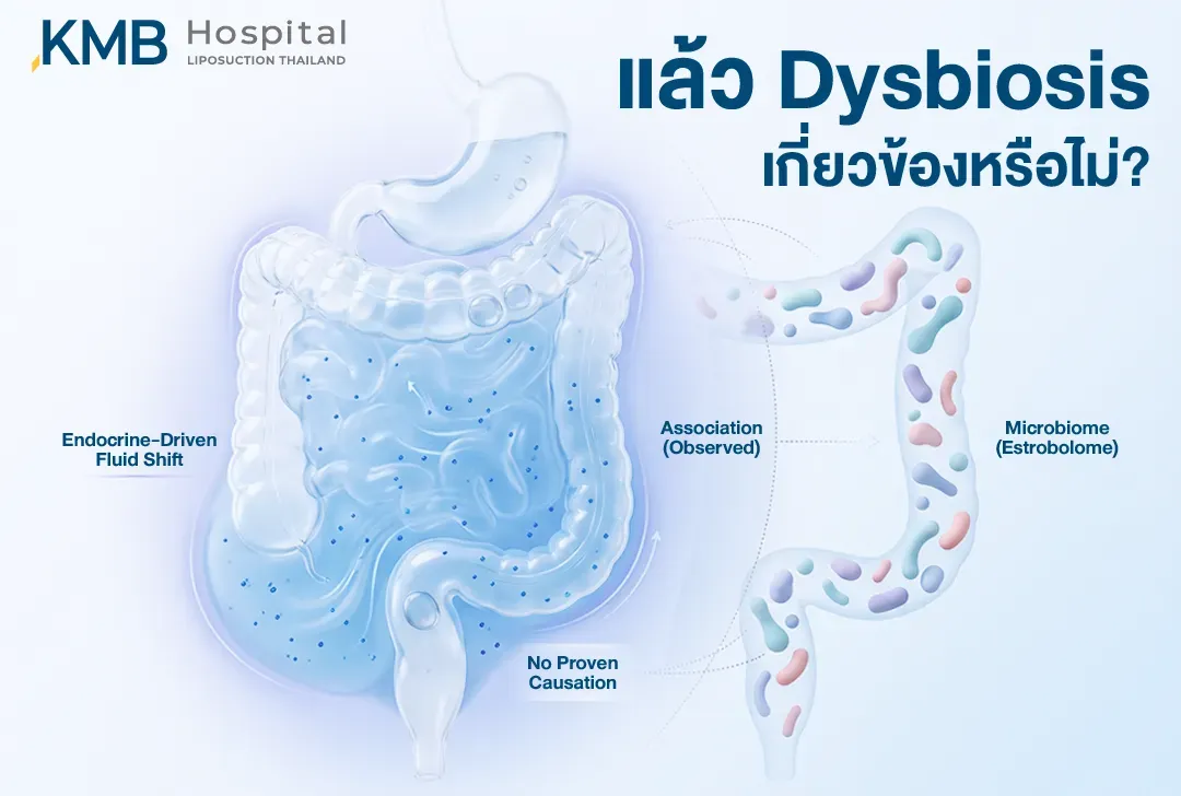 อินโฟกราฟิกเปรียบเทียบการเปลี่ยนแปลงของของเหลวจากฮอร์โมนกับภาวะ Dysbiosis และ Microbiome ในอาการท้องอืดก่อนมีประจำเดือน โดยพบเพียงความสัมพันธ์และยังไม่มีหลักฐานยืนยันว่าเป็นสาเหตุโดยตรง