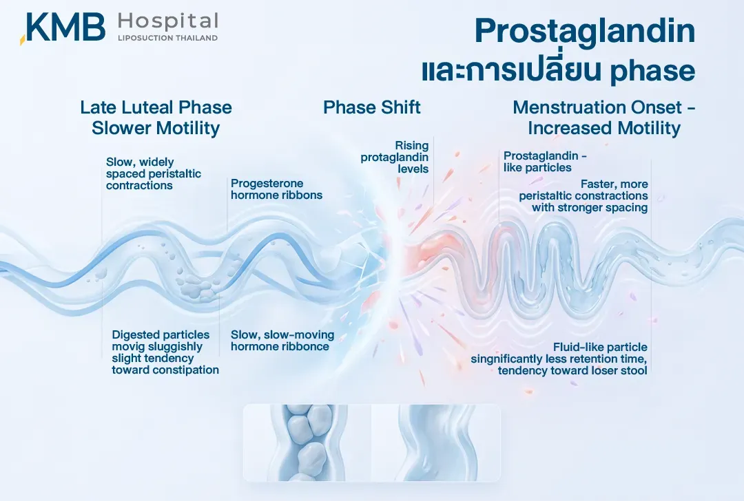 นโฟกราฟิกเปรียบเทียบการเคลื่อนไหวของลำไส้ช่วงปลายระยะ Luteal ที่อาจช้าลงและมีแนวโน้มถ่ายยาก กับช่วงเริ่มมีประจำเดือนที่ระดับ Prostaglandin เพิ่มขึ้นและอาจกระตุ้นการบีบตัวของลำไส้ ทำให้อุจจาระนิ่มหรือถ่ายบ่อยขึ้น