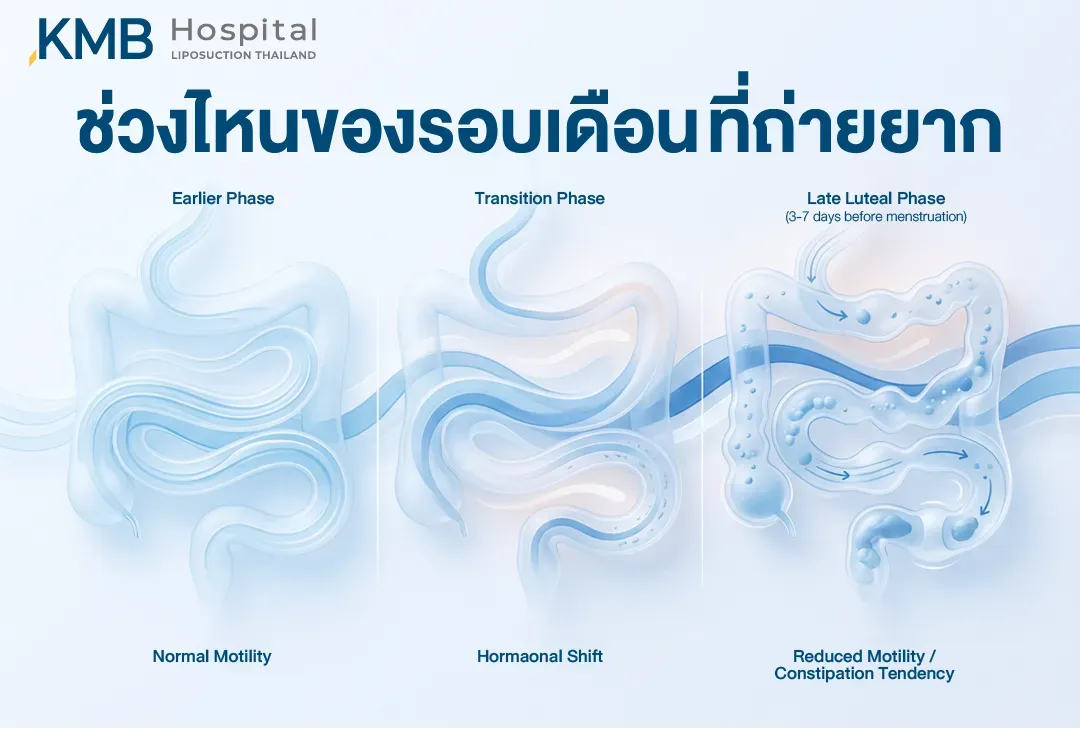 อินโฟกราฟิกเปรียบเทียบการเคลื่อนไหวของลำไส้ในแต่ละช่วงของรอบเดือน ตั้งแต่ระยะแรกที่ลำไส้เคลื่อนไหวตามปกติ ช่วงเปลี่ยนผ่านของฮอร์โมน จนถึงระยะ Late Luteal ก่อนมีประจำเดือน 3–7 วัน ซึ่งอาจมีการเคลื่อนไหวของลำไส้ลดลงและมีแนวโน้มถ่ายยาก