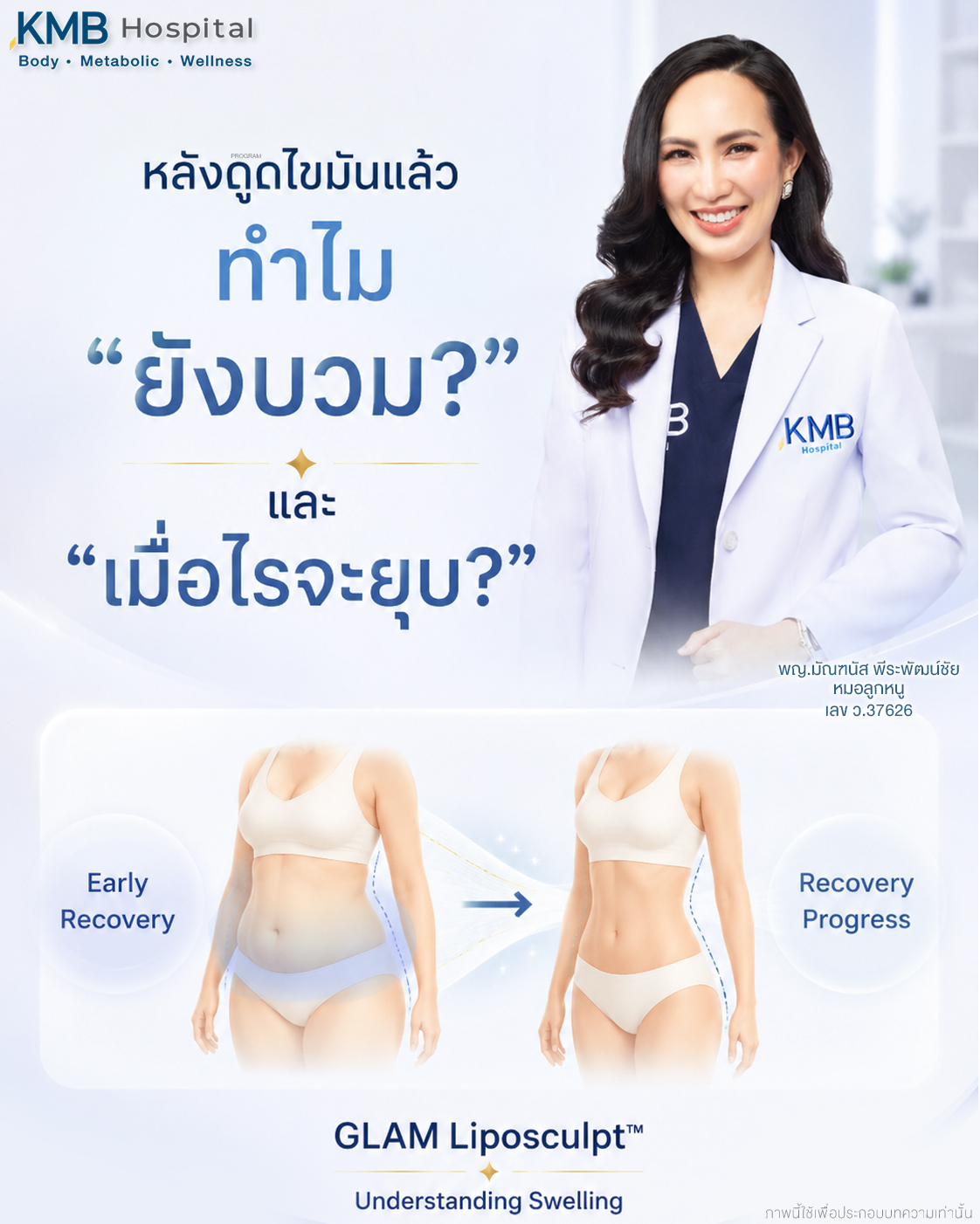อาการบวมเป็นหนึ่งในเรื่องที่ผู้รับบริการสงสัยมากที่สุดในช่วงแรกหลังดูดไขมัน และจะอธิบายต่อในบทเรื่องอาการบวมโดยเฉพาะ