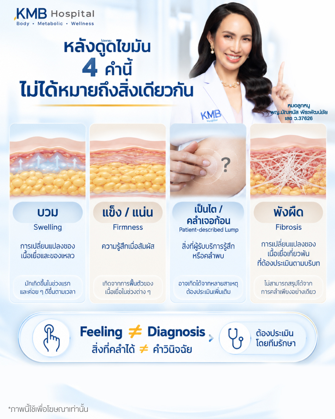 อินโฟกราฟิกอธิบายความแตกต่างระหว่างบวม ความแข็ง ไต และพังผืดหลังดูดไขมัน