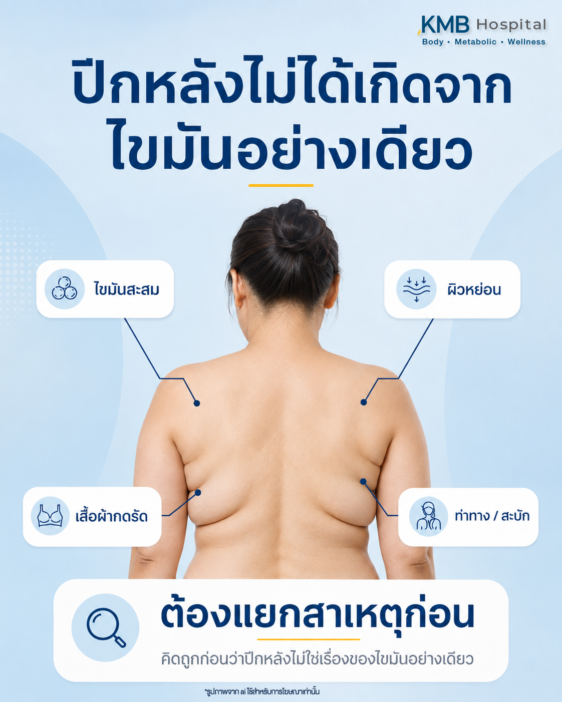 อินโฟกราฟิก KMB Hospital อธิบายว่าปีกหลังไม่ได้เกิดจากไขมันเพียงอย่างเดียว โดยอาจสัมพันธ์กับไขมันสะสม ผิวหย่อน เสื้อผ้ากดรัด และลักษณะท่าทางหรือสะบัก จึงควรแยกสาเหตุก่อนวางแผนดูแล