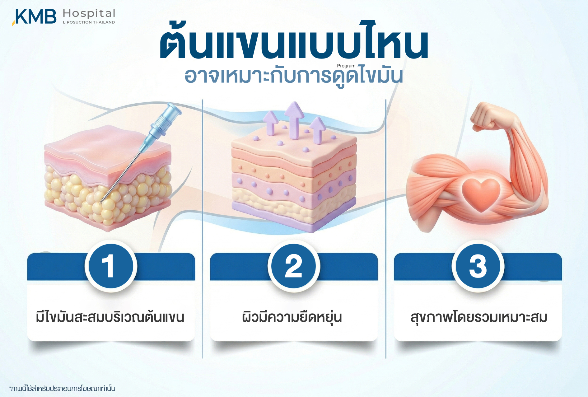 อินโฟกราฟิก KMB Hospital อธิบายลักษณะต้นแขนที่อาจเหมาะกับโปรแกรมดูดไขมัน ได้แก่ มีไขมันสะสมบริเวณต้นแขน ผิวยังมีความยืดหยุ่น และมีสุขภาพโดยรวมเหมาะสม