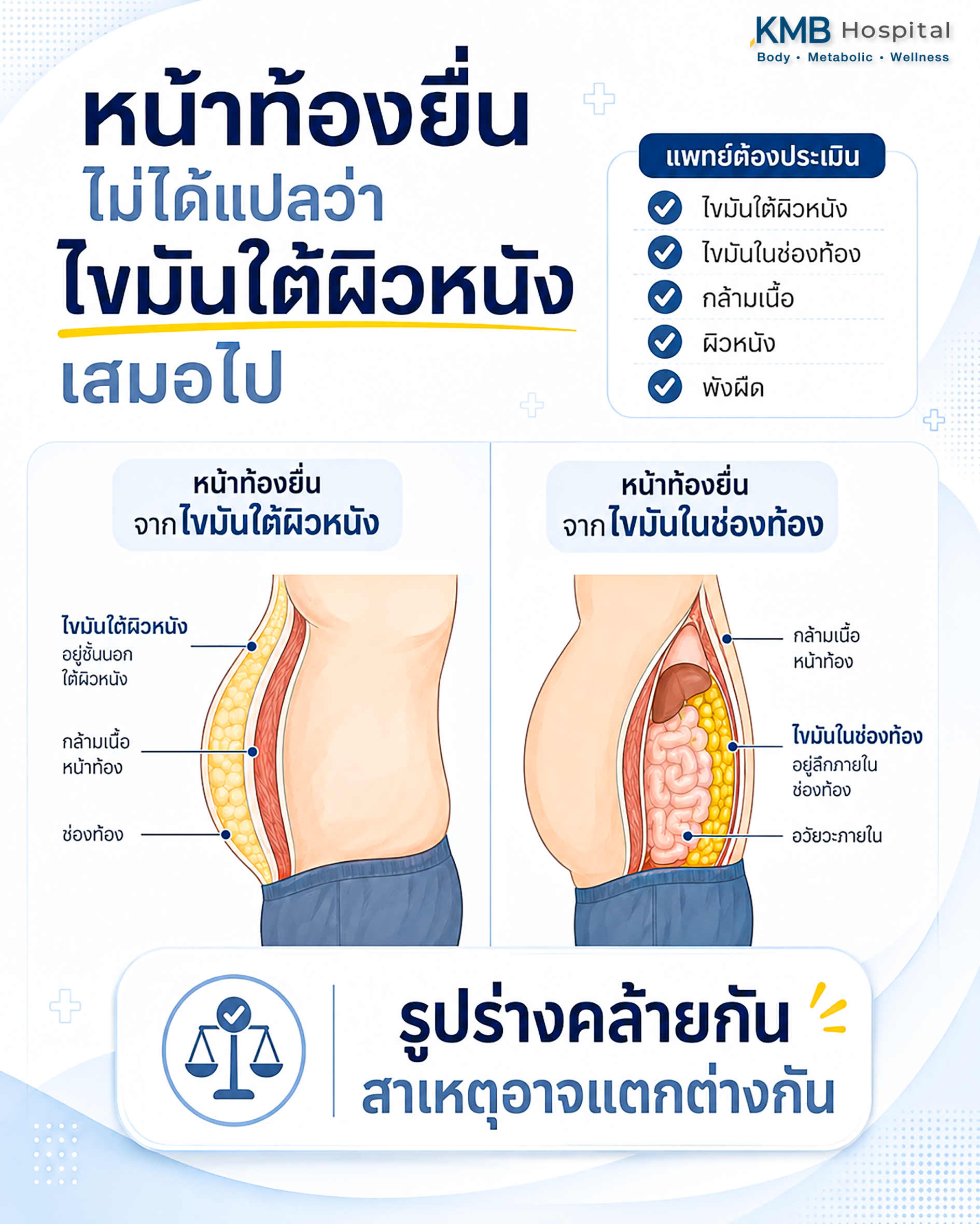 อินโฟกราฟิกเปรียบเทียบหน้าท้องที่ยื่นจากไขมันใต้ผิวหนังและไขมันในช่องท้อง พร้อมองค์ประกอบที่แพทย์ใช้ประเมินก่อนดูดไขมัน