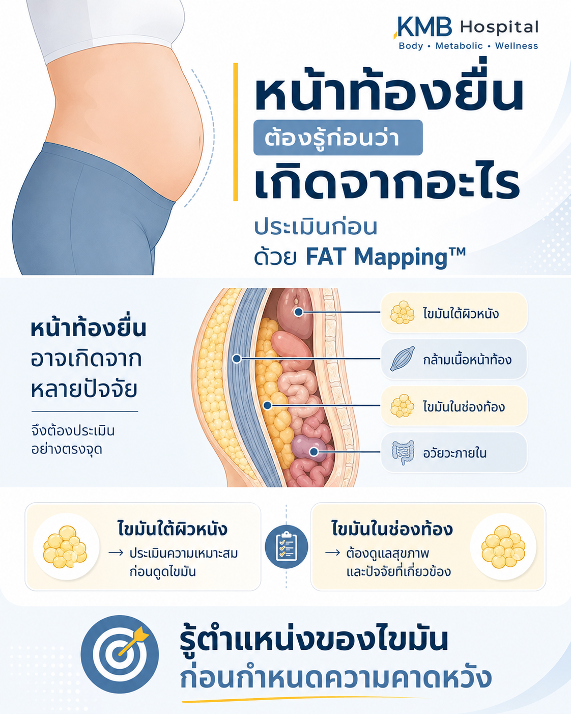 อินโฟกราฟิกเปรียบเทียบไขมันใต้ผิวหนังกับไขมันในช่องท้อง และอธิบายว่าการดูดไขมันไม่สามารถนำไขมันรอบอวัยวะภายในออกได้