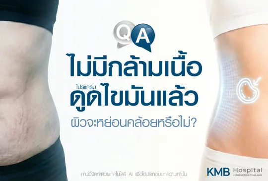 ภาพปกบทความ KMB Hospital เปรียบเทียบลักษณะหน้าท้องก่อนและหลังโปรแกรมดูดไขมัน เพื่ออธิบายว่าหากมวลกล้ามเนื้อน้อย ผิวหลังทำอาจกระชับหรือหย่อนคล้อยแตกต่างกันตามคุณภาพผิวและโครงสร้างร่างกาย