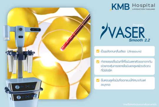 VASER Smooth2.2